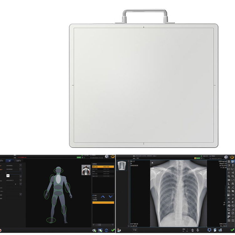 Detector plano para digitalizador Rayos X Marca LG